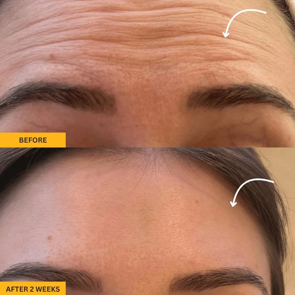 Lymphatic Contour Face Brush™