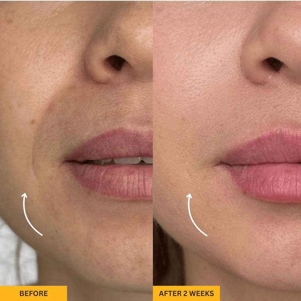 Lymphatic Contour Face Brush™