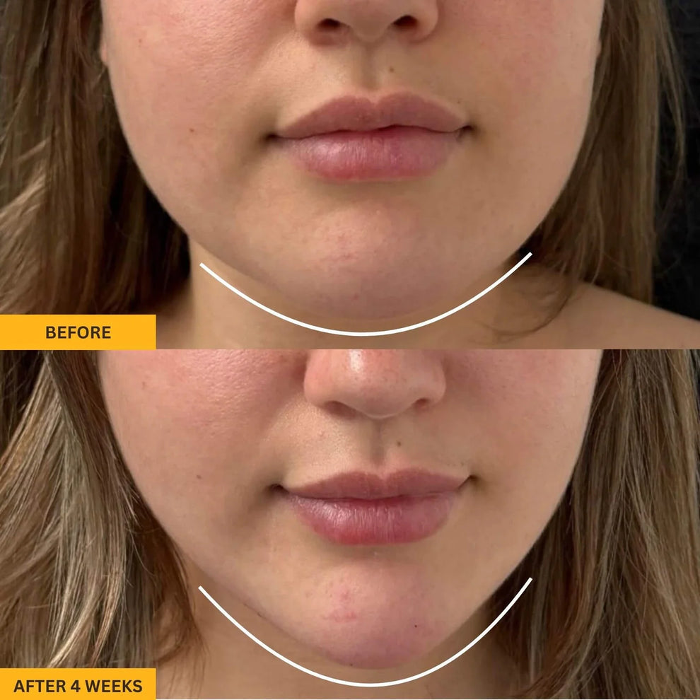 Lymphatic Contour Face Brush™