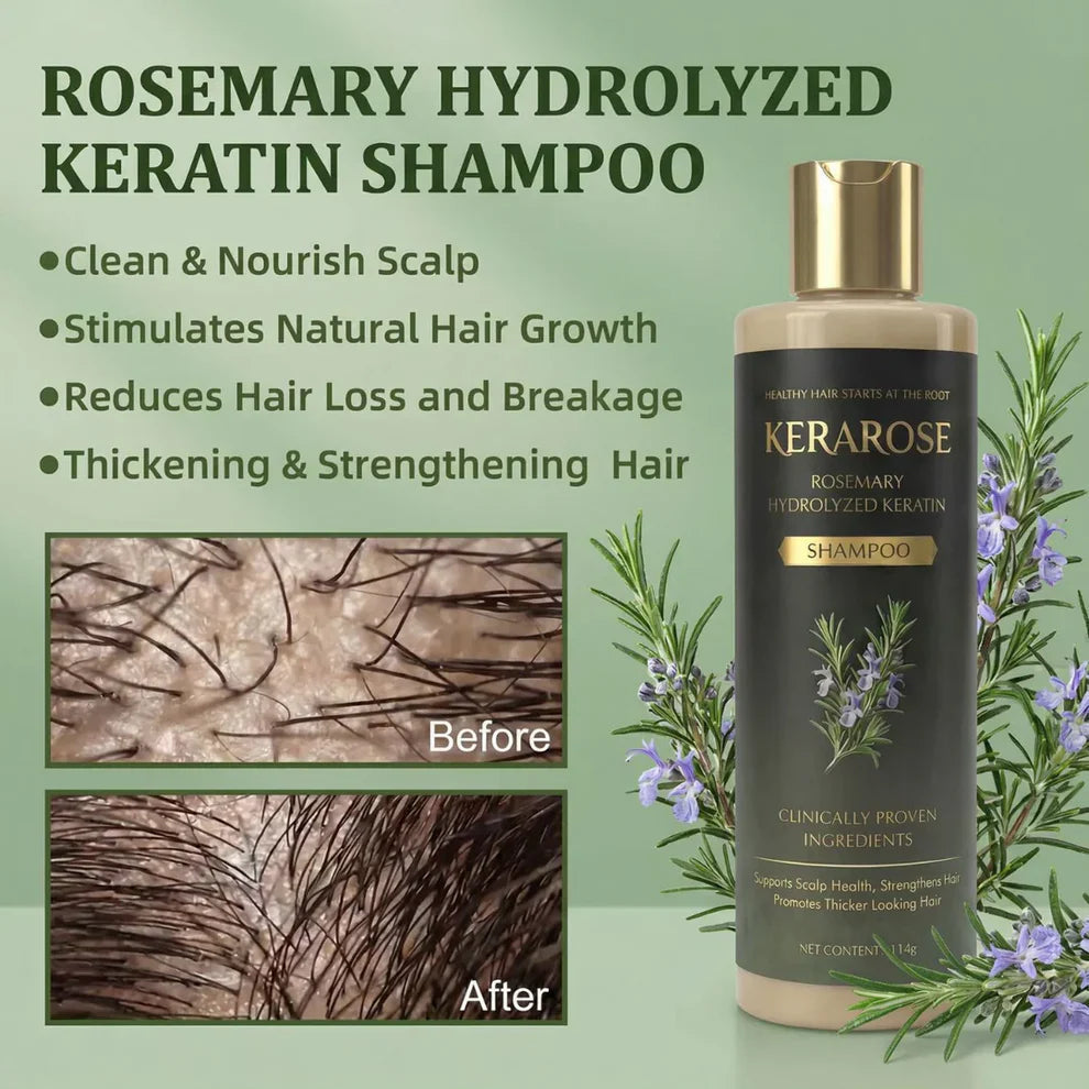 Kerarose Rosemary Shampoo For Hair Growth.