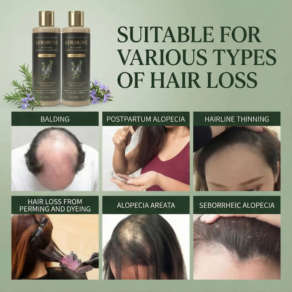 Kerarose Rosemary Shampoo For Hair Growth.